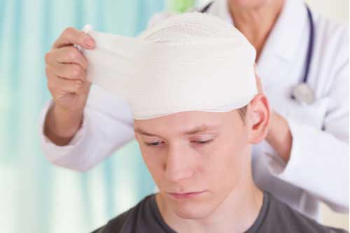 Head injury treatment