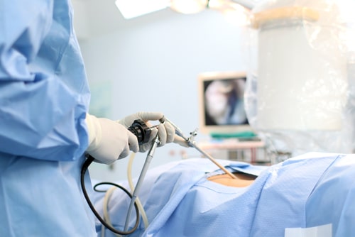 Types of minimally invasive procedures