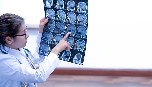 traumatic brain injuries must be diagnosed and treated as soon as possible.