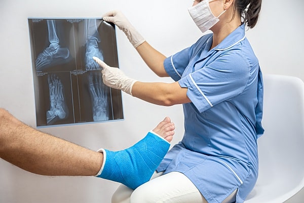 A doctor explaining common types of fractures.